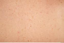 Photo Textures of Human Skin